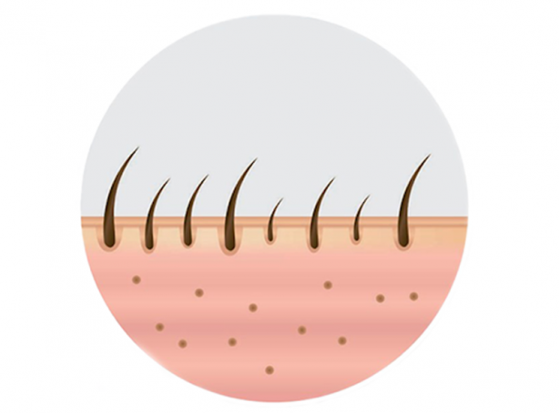 Foto - Saçı dökülenler dikkat! Durduruyor... Artık bu besinleri severek yiyeceksiniz