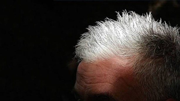 Foto - Saçlar neden beyazlar?