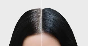 Foto - Saçlardaki beyazlıklar nasıl kapatılır? Duyan kulaklarına inanamadı! İşte kesin çözen gıda ve o yöntemler