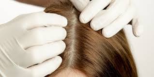 Foto - Saçlardaki beyazlıklar nasıl kapatılır? Duyan kulaklarına inanamadı! İşte kesin çözen gıda ve o yöntemler