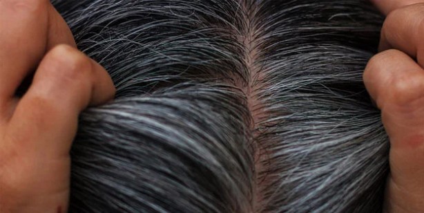 Foto - Saçlardaki beyazlıklar nasıl kapatılır? Duyan kulaklarına inanamadı! İşte kesin çözen gıda ve o yöntemler