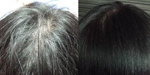 Saçlardaki beyazlıklar nasıl kapatılır? Duyan kulaklarına inanamadı! İşte kesin çözen gıda ve o yöntemler