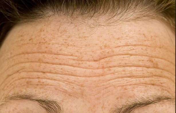 Foto - Saçları dökülenler bu habere dikkat: Bir avuç tüketmek bile etki ediyor