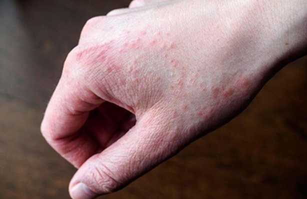 Foto - Saçları dökülenler bu habere dikkat: Bir avuç tüketmek bile etki ediyor