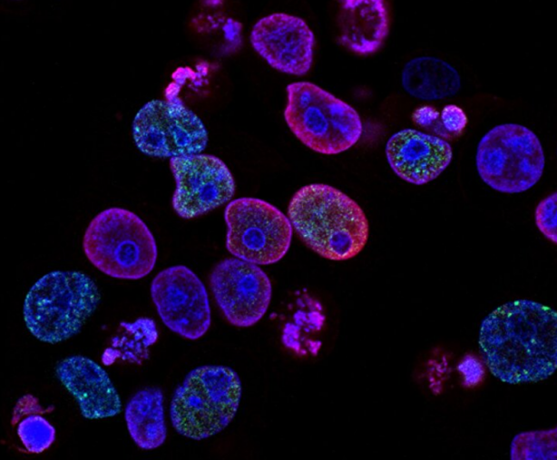 Foto - Saçları dökülenler bu habere dikkat: Bir avuç tüketmek bile etki ediyor