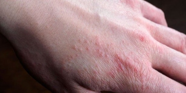 Foto - Saçlarınız ıslakken asla uyumayın: Çok fena etkisi, çok şaşırtacak! Uzmanlar tek tek açıkladı! Herkes şaşkın