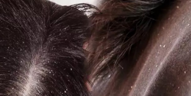 Foto - Saçlarınız ıslakken asla uyumayın: Çok fena etkisi, çok şaşırtacak! Uzmanlar tek tek açıkladı! Herkes şaşkın