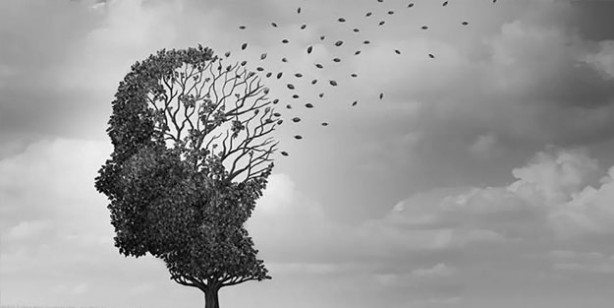 Foto - Saçtaki bu değişiklik 'Alzheimer' belirtisi olabilir