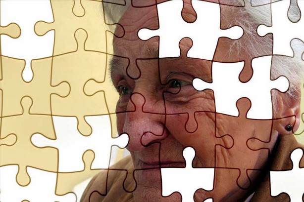 Foto - Saçtaki bu değişiklik 'Alzheimer' belirtisi olabilir