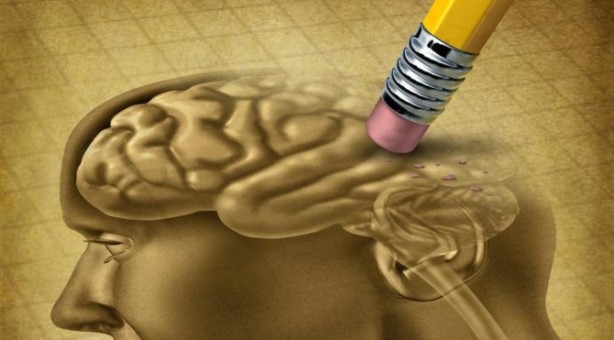 Foto - Saçtaki bu değişiklik 'Alzheimer' belirtisi olabilir