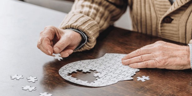 Foto - Saçtaki bu değişiklik 'Alzheimer' belirtisi olabilir