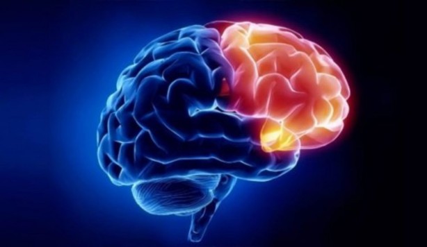 Foto - Saçtaki bu değişiklik 'Alzheimer' belirtisi olabilir