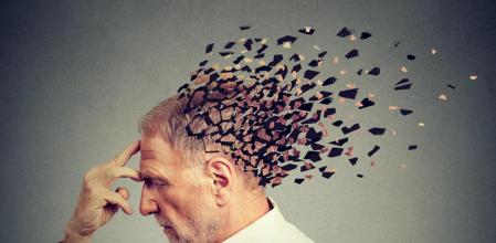 Foto - Saçtaki bu değişiklik 'Alzheimer' belirtisi olabilir