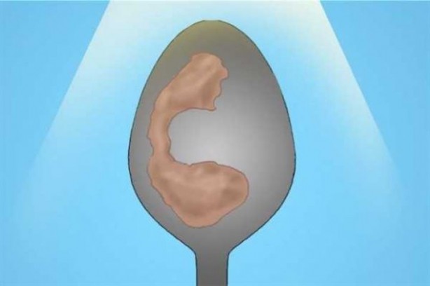 Foto - Sadece bir kaşık yardımıyla hastalıklarınızı öğrenebilirsiniz