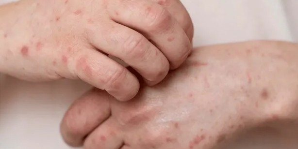 Foto - Sadece Ordu, Samsun, Giresun Tokat ve Sivas değil tüm Türkiye tehlikede 4,5 kat arttı Gece ortaya çıkıyor