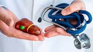 Foto - Safra kesesi taşlarını 7 günde düşüren doğal yöntem efsane: Pek bilinmeyen uygulama! Adeta savaş açıyor