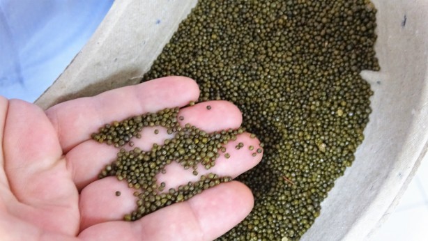 Foto - Safra kesesinden çıkanlar doktorları bile şoke etti! Guinness'e başvuru yapacaklar