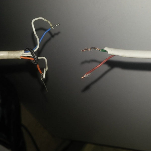 Foto - Sağlık çalışanı böyle anlattı: Çocuğun kafasından çıkanlara inanamazsınız!