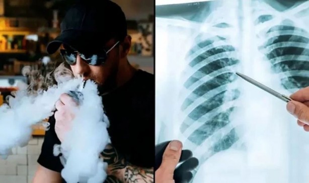 Foto - Sağlık sorunlarına neden oluyordu! Elektronik sigara devi milyonlarca dolar tazminat ödeyecek