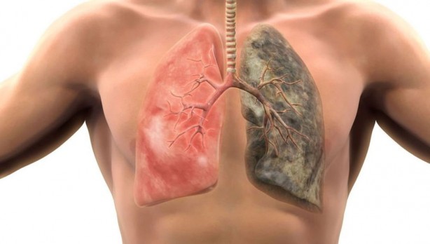 Foto - Sağlık sorunlarına neden oluyordu! Elektronik sigara devi milyonlarca dolar tazminat ödeyecek