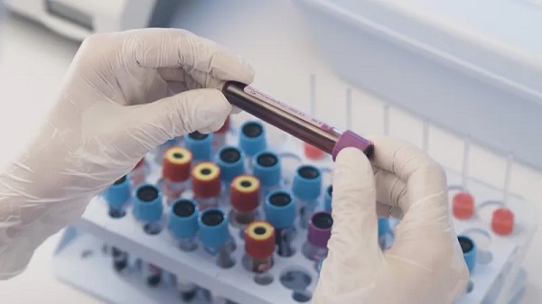 Foto - Sağlıklı beslenmek isteyenler merak ediyor! Hangi kan grubu nasıl beslenmeli? 