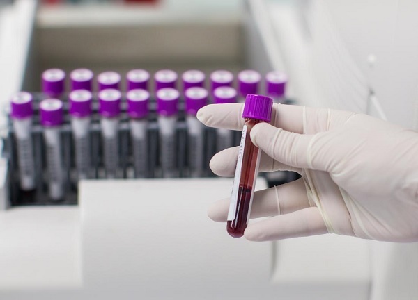 Foto - Sağlıklı beslenmek isteyenler merak ediyor! Hangi kan grubu nasıl beslenmeli? 