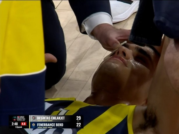 Foto - Sahaya yabancı cisim atılmıştı! Fenerbahçe’den o oyuncu için açıklama geldi: Görme kaybı var!