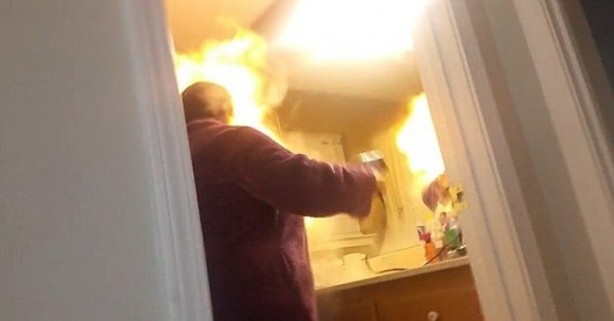 Foto - Şaka yapmak isterken karısının yüzünü yaktı