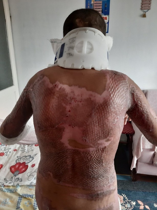 Foto - Sakın bu hataları yapmayın! İlk yardımda doğru bilinen yanlışlar...
