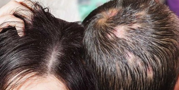 Foto - Şampuana şeker ekleyin farkı görün! Şampuanınıza şeker eklerseniz...