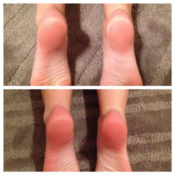 Foto - Şampuanınıza 3 yemek kaşığı tuz dökerseniz...