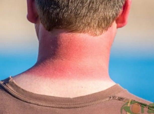 Foto - Şampuanınıza kabartma tozu koyarsanız...