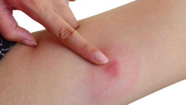 Foto - Şampuanınıza katarsanız bakın ne oluyor! Şaşırtıcı derecede gerçek...