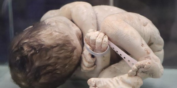 Samsun'da bu müzeye giren şaşkına dönüyor! Bu halde sergileniyorlar! Asırlık cerrahi aletler bu müzede