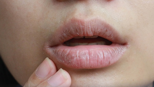 Foto - Sanıldığı gibi değil! Ağız kuruluğunda büyük tehlike