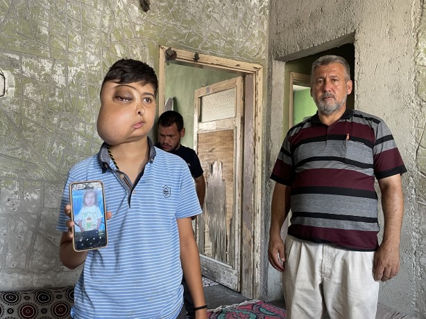 Foto - Sanki iki farklı yüzü var...! Hastalığı için yardım bekliyor