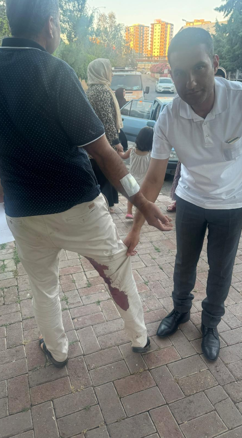 Foto - Şanlıurfa’da vatandaşı ısıran köpek kuduz çıktı