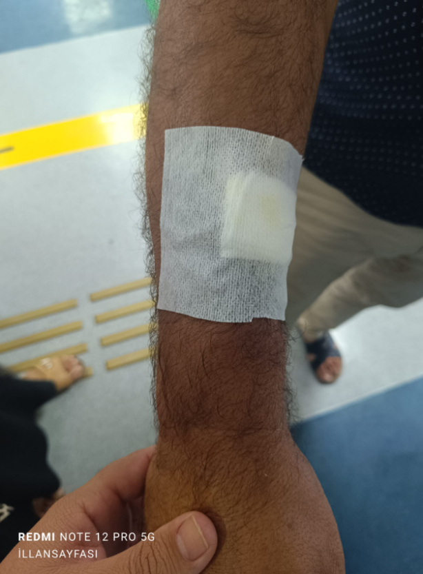 Foto - Şanlıurfa’da vatandaşı ısıran köpek kuduz çıktı