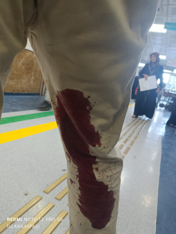 Foto - Şanlıurfa’da vatandaşı ısıran köpek kuduz çıktı