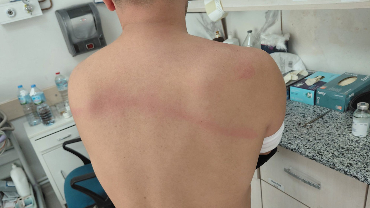 Foto - Şantaj, taciz, dayak ne ararsan bu partide var! CHP'li başkan zabıtayı sopayla dövdü