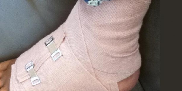 Foto - Sargı üzerine mesh edilebilir mi? Abdest alırken yara bandı çıkarılır mı?