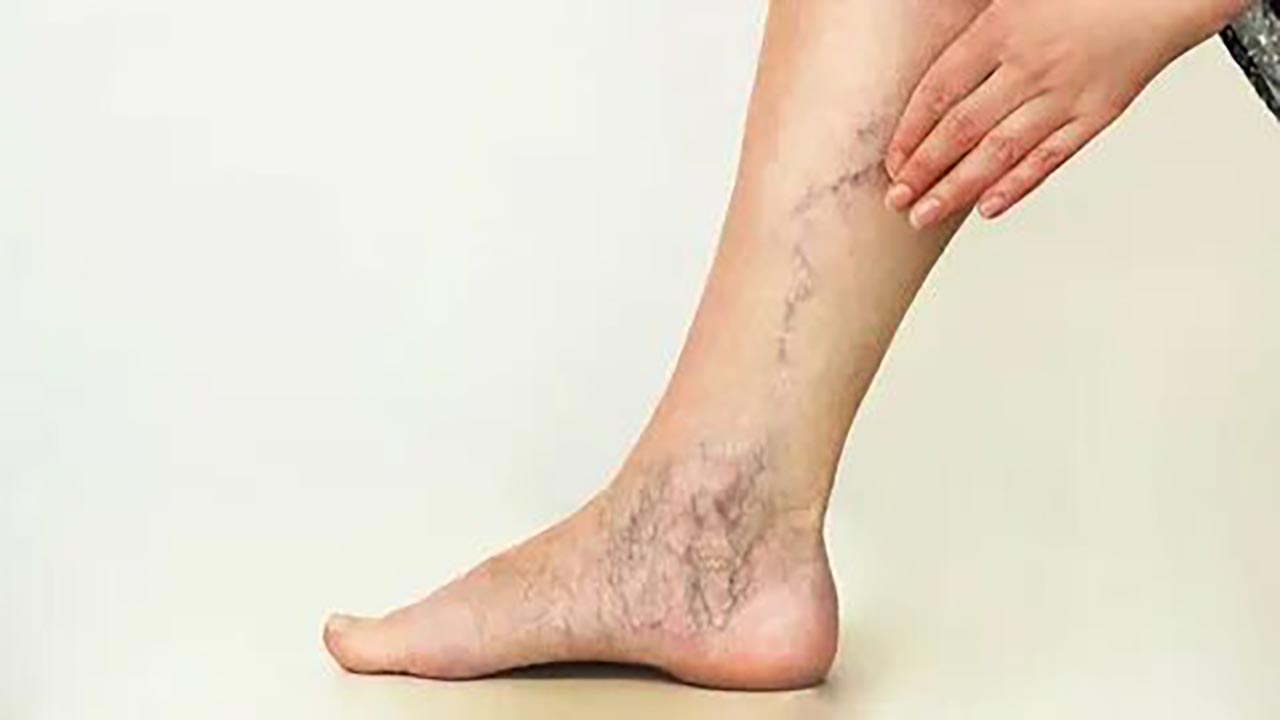 Foto - Sarımsak ve karanfilin mucize faydası ortaya çıktı! O hastalığı silip atıyor