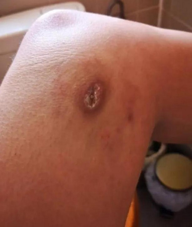 Foto - Şarj aletiyle yattı, sabah olanları görünce hastaneye attı kendini! 