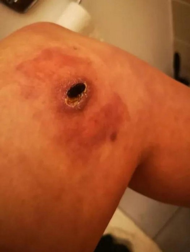 Şarj aletiyle yattı, sabah olanları görünce hastaneye attı kendini! 