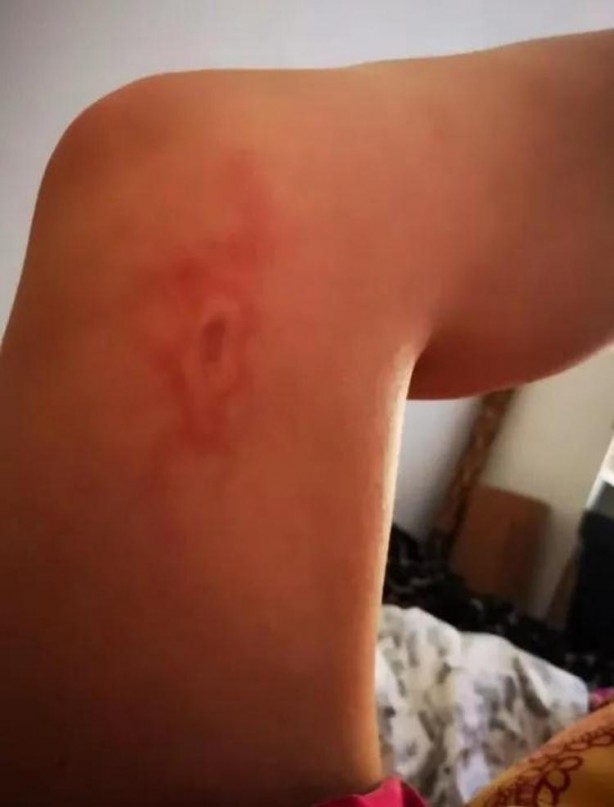 Foto - Şarj aletiyle yattı, sabah olanları görünce hastaneye attı kendini! 