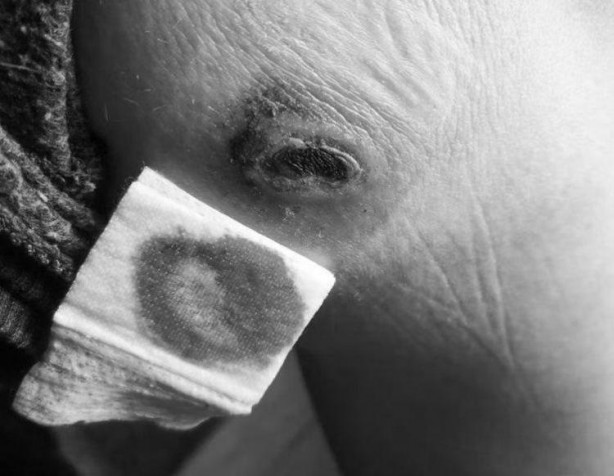 Foto - Şarj aletiyle yattı, sabah olanları görünce hastaneye attı kendini! 