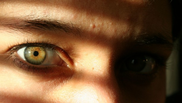 Foto - Şaşkına çeviren araştırma! Bu göz rengine sahip olanlar dikkat! Kansere yakalanma ihtimaliniz daha fazla