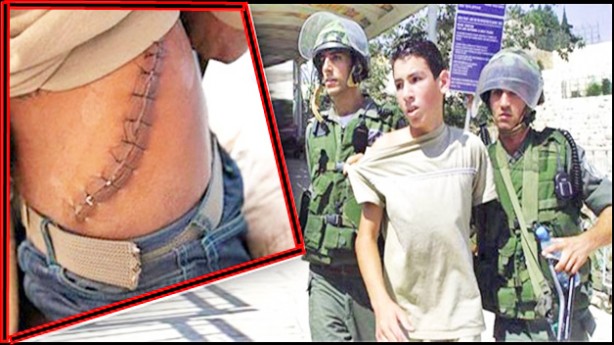 Foto - Savaşı kim başlattı?