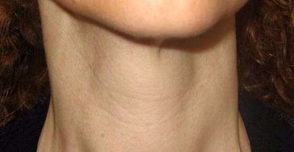 Foto - Sebepsiz kilo artışınız varsa...