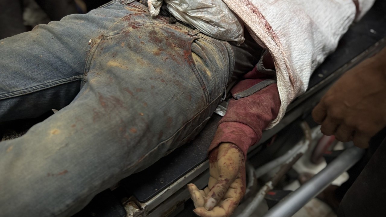 Foto - Şehit ve yaralılar var! Bu görüntülere yürek nasıl dayanır